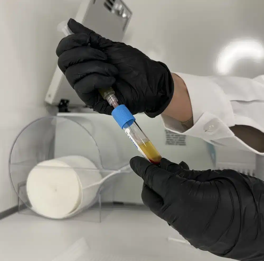 Lab technician processing a urine sample for DOT medical certification testing