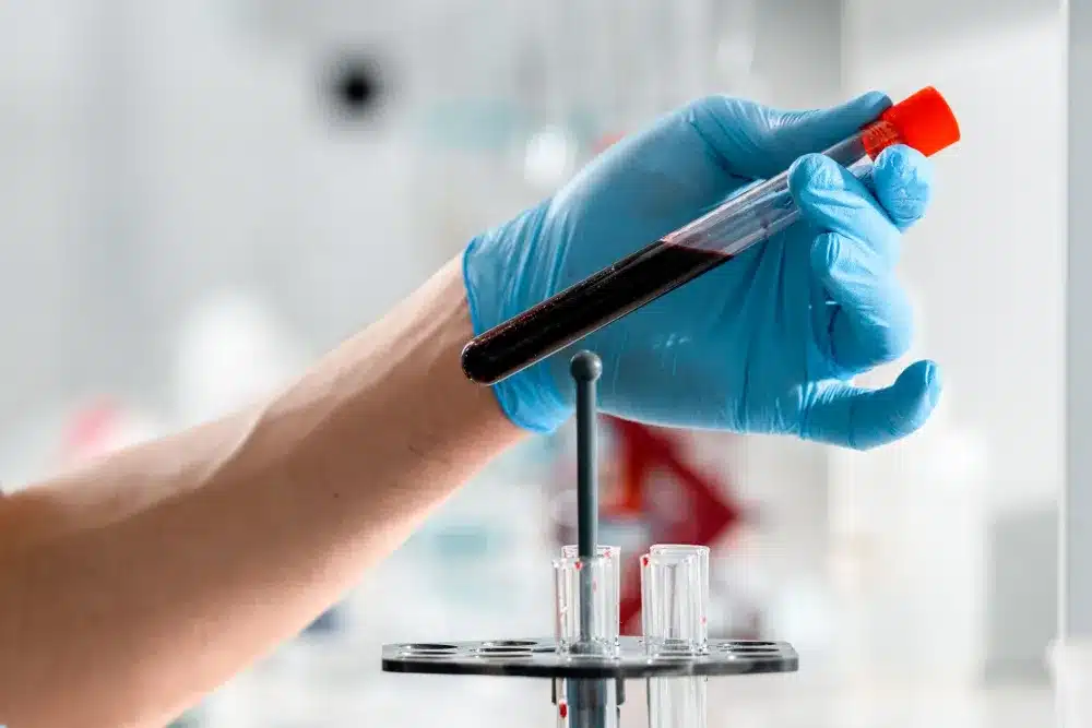 Lab technician drawing blood for on-site diagnostic testing at urgent care