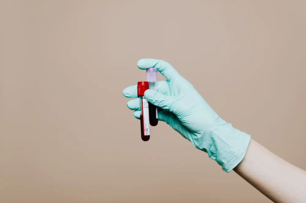 Lab technician processing diagnostic blood samples for digestive health evaluation