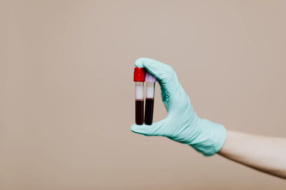 Lab technician drawing blood for weight loss metabolic panel testing at Burleson clinic